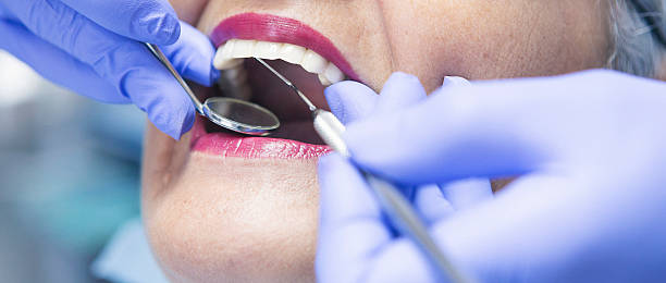 Best Emergency Dentist for Lost Fillings or Crowns in Estelle, LA